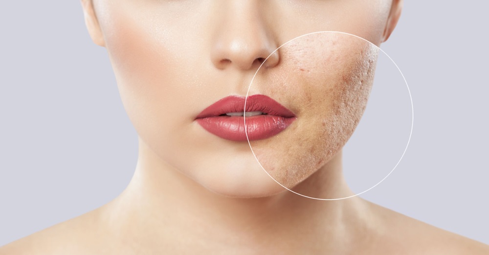 Revitalize Your Skin: Harnessing Regenerative Cellular Technology with Face Masks